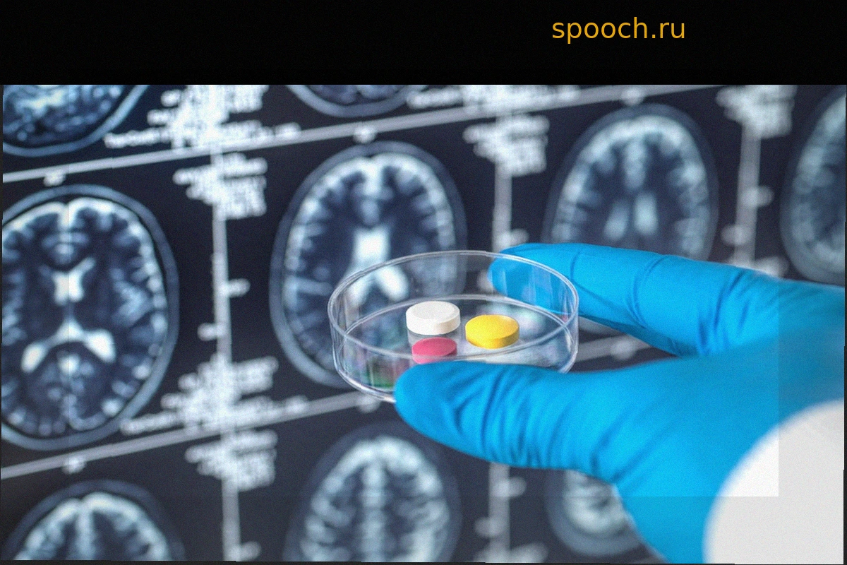 Болезнь Альцгеймера: как отмена возмещения стоимости лекарств ускоряет ухудшение состояния пациентов